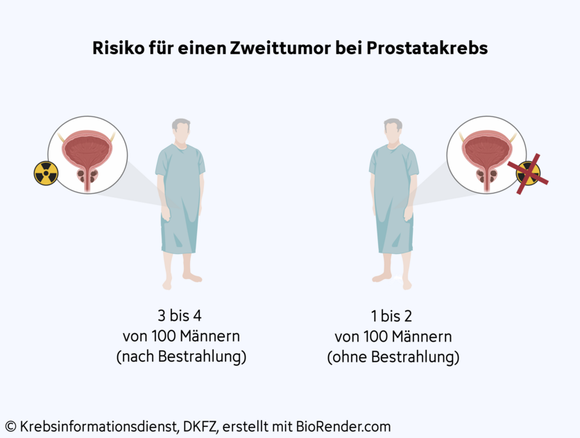Zweittumor nach Bestrahlung, © Krebsinformationsdienst, DKFZ; erstellt mit BioRender.com Grafische Darstellung: Unter 100 bestrahlten Patienten sind etwa 1 bis 2 Männer mehr von einem Zweittumor betroffen, als Männer, die keine Strahlentherapie erhalten haben.