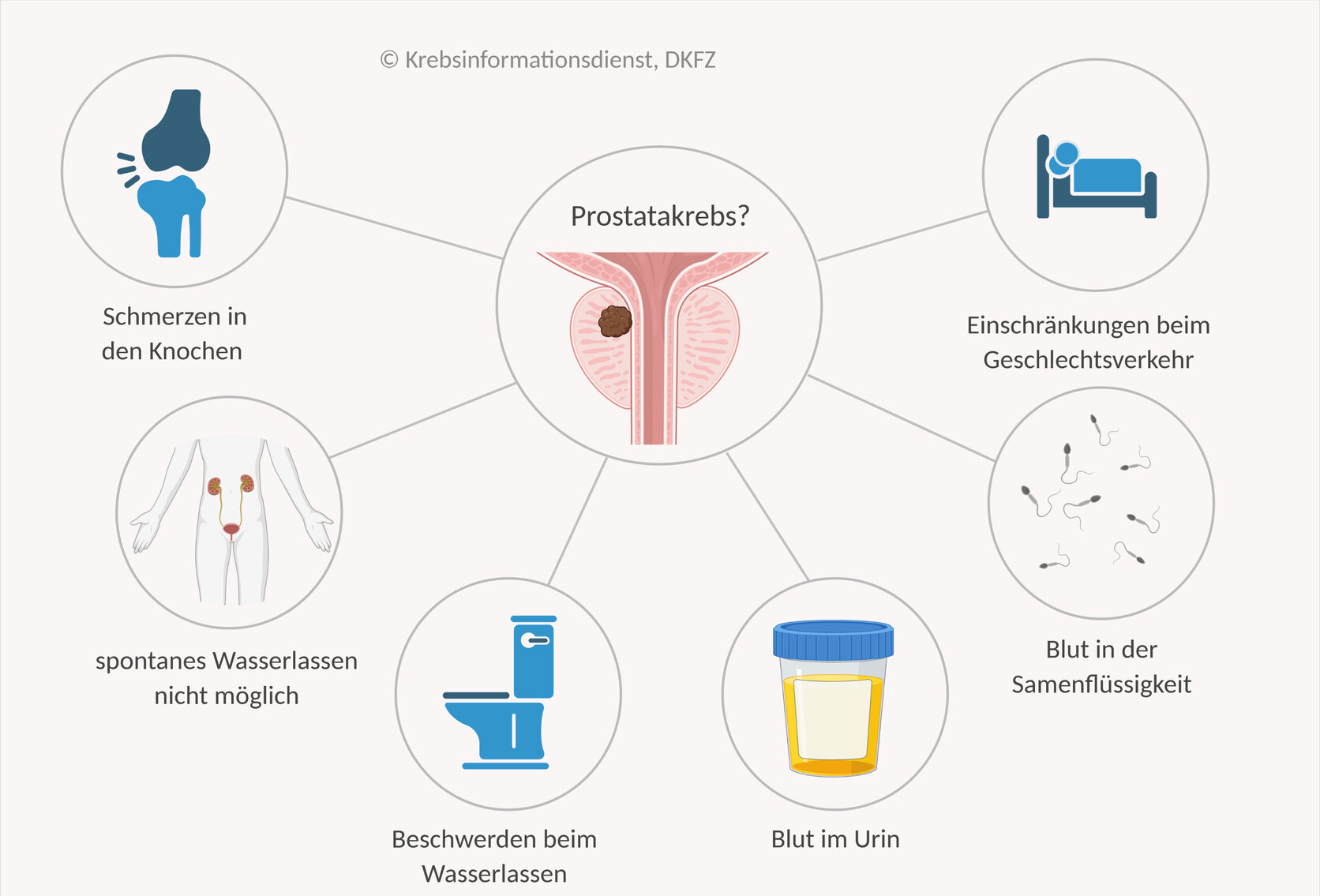 Blut Im Urin Bei Prostatakrebs www.krebsinformationsdienst.de