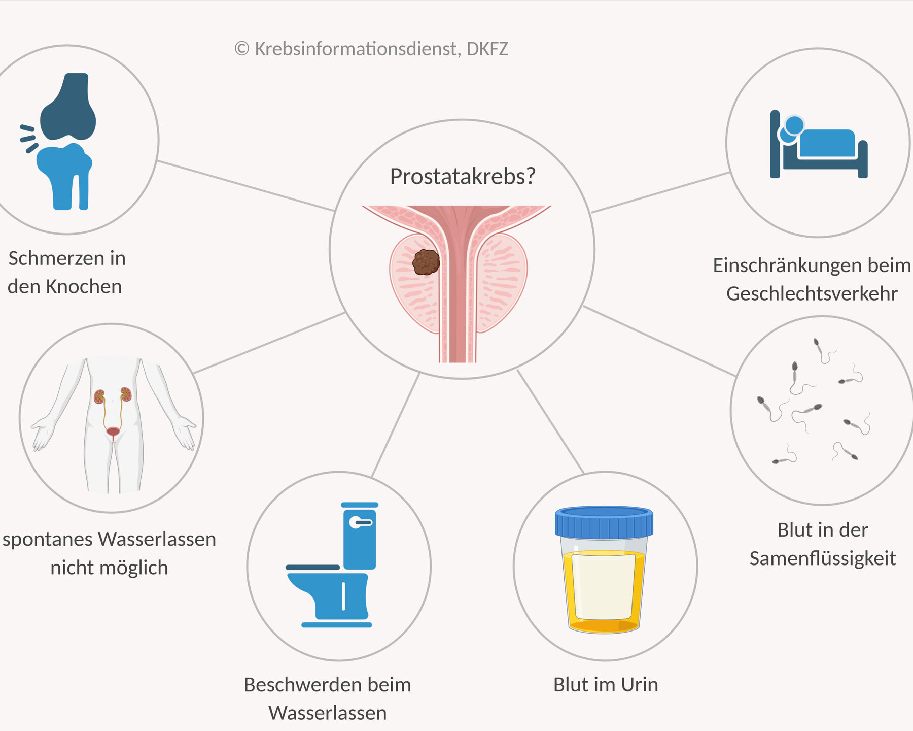 Wie Lange Lebt Man Mit Prostatakrebs www.krebsinformationsdienst.de