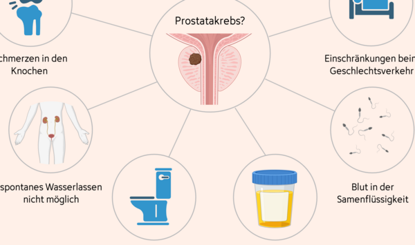 Mindmap möglicher Beschwerden bei Prostatakrebs: Knochenschmerzen, Blut in Urin oder Samenflüssigkeit, Beschwerden beim Wasserlassen, spontanes Wasserlassen nicht möglich und Einschränkungen beim Geschlechtsverkehr.