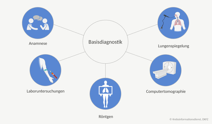 Basisdiagnostik bei Lungenkrebs , © Krebsinformationsdienst, DKFZ; erstellt mit BioRender.com Zur Basisdiagnostik bei Lungenkrebs gehören das Erfragen der Krankheitsvorgeschichte (Anamnese), die körperliche Untersuchung, Laboruntersuchungen, Röntgen der Brust, Computertomographie (CT) der Brust und die Lungenspiegelung (Bronchoskopie)