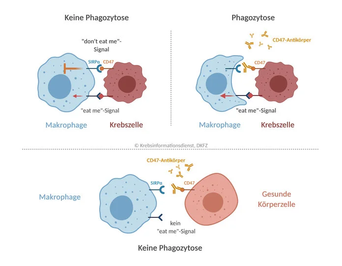 Wirkmechanismus des CD47-Antikörpers Magrolimab © Krebsinformationsdienst, Deutsches Krebsforschungszentrum, erstellt mit BioRender.com, Krebsinformationsdienst, DKFZ, erstellt mit BioRender.com Bild 1: Krebszellen mit „eat-me“-Signalen und dem „don’t eat me-Signal CD47 werden durch Makrophagen nicht phagozytiert. Bild 2: Blockieren CD47-Antikörper das „don’t eat me-Signal, wird die Phagozytose über „eat-me“-Signale eingeleitet. Bild 3: Gesunde Körperzellen haben kein „eat-me“-Signal. Die CD47-Blockade löst keine Phagozytose aus.
