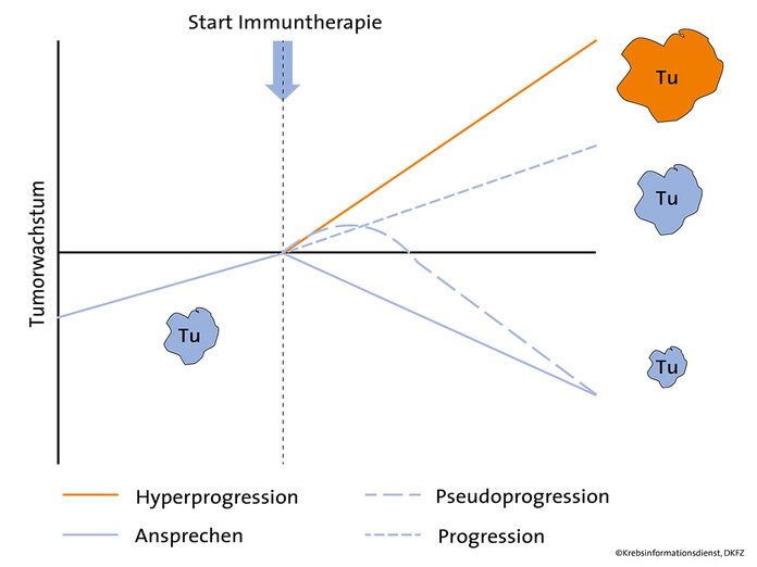 Hyperprogression, Krebsinformationsdienst, Deutsches Krebsforschungszentrum Hyperprogression ist unter Immuntherapie möglich. © Krebsinformationsdienst, Deutsches Krebsforschungszentrum