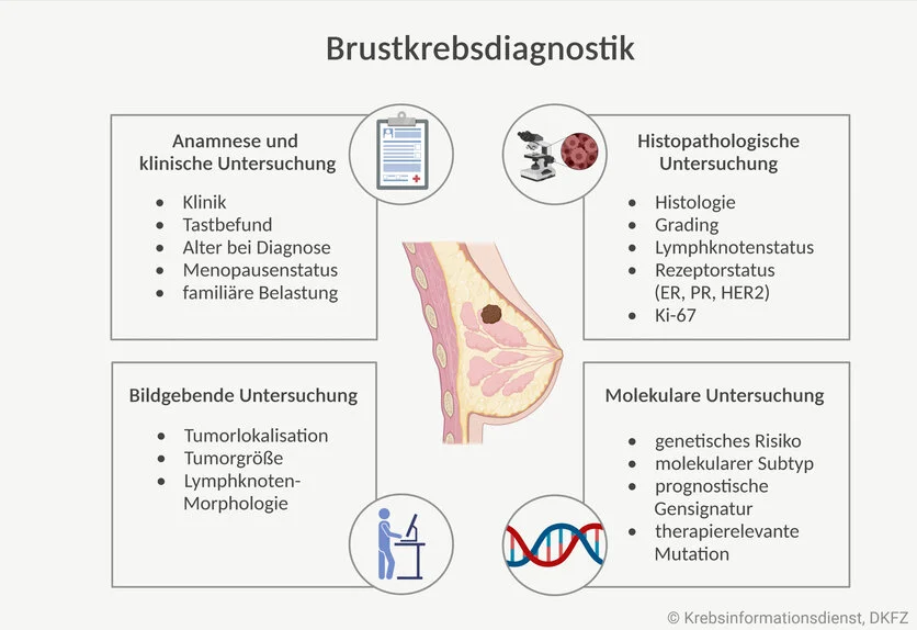 Brustkrebs-Diagnostik , © Krebsinformationsdienst, DKFZ, erstellt mit BioRender.com Die Grafik zeigt verschiedene Bausteine der Brustkrebsdiagnostik: Anamnese und klinische Untersuchung sowie bildgebende, histopathologische und molekulare Diagnostik.