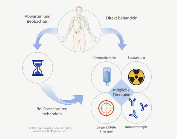 Therapieoptionen bei Lymphomen, © Krebsinformationsdienst, DKFZ; erstellt mit BioRender.com Therapieoptionen bei Lymphomen sind grafisch dargestellt: Zur direkten Behandlung eignen sich zum Beispiel Chemotherapie, Bestrahlung, zielgerichtete Therapie, Immuntherapie; bei manchen Lymphomen ist auch Abwarten und Beobachten eine Option.