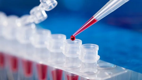 Pipettieren im Labor Flüssigkeit wird mit Pipette in kleine Röhrchen gegeben.