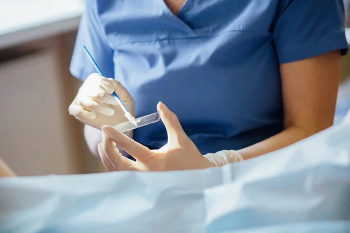 Ausstrich von Zellen auf einen Objektträger , © Iryna Inshyna, Shutterstock Eine Frau streicht Zellmaterial mit einem Spatel auf einen Objektträger aus.