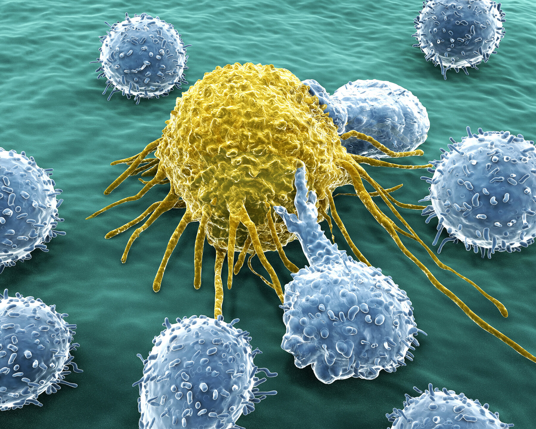 Ist Ein Tumor Gleich Krebs www.krebsinformationsdienst.de
