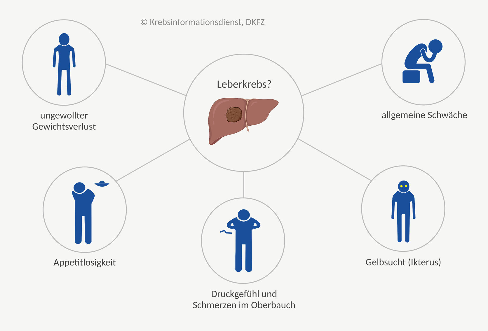 Wasser Im Bauch Bei Leberkrebs www.krebsinformationsdienst.de