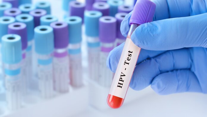 Hand mit Probenröhrchen "HPV-Test", im Hintergrund weitere Röhrchen.