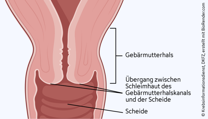 Gebärmutterhals, Schleimhaut, © Krebsinformationsdienst, DKFZ; erstellt mit BioRender.com Schematische Darstellung des Übergangsbereichs der Schleimhaut von Scheide und Gebärmutterhalskanal.