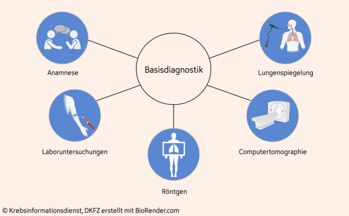 Basisdiagnostik bei Lungenkrebs , © Krebsinformationsdienst, DKFZ; erstellt mit BioRender.com Zur Basisdiagnostik bei Lungenkrebs gehören das Erfragen der Krankheitsvorgeschichte (Anamnese), die körperliche Untersuchung, Laboruntersuchungen, Röntgen der Brust, Computertomographie (CT) der Brust und die Lungenspiegelung (Bronchoskopie)
