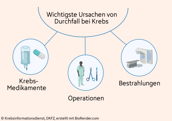 Grafische Darstellung der wichtigsten Ursachen von Durchfall bei Krebs: Krebs-Medikamente, Operationsfolgen und Bestrahlungen