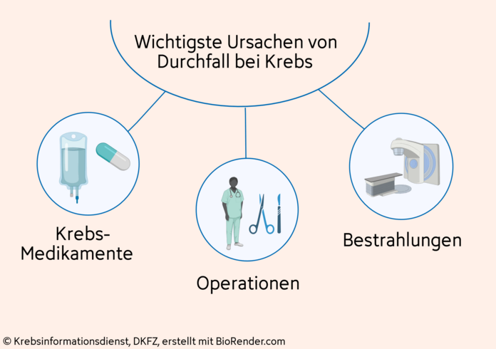 Grafische Darstellung der wichtigsten Ursachen von Durchfall bei Krebs: Krebs-Medikamente, Operationsfolgen und Bestrahlungen