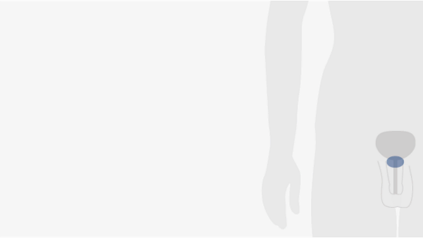 Prostatakrebs Die Prostata gehört zu den inneren Geschlechtsorganen des Mannes.