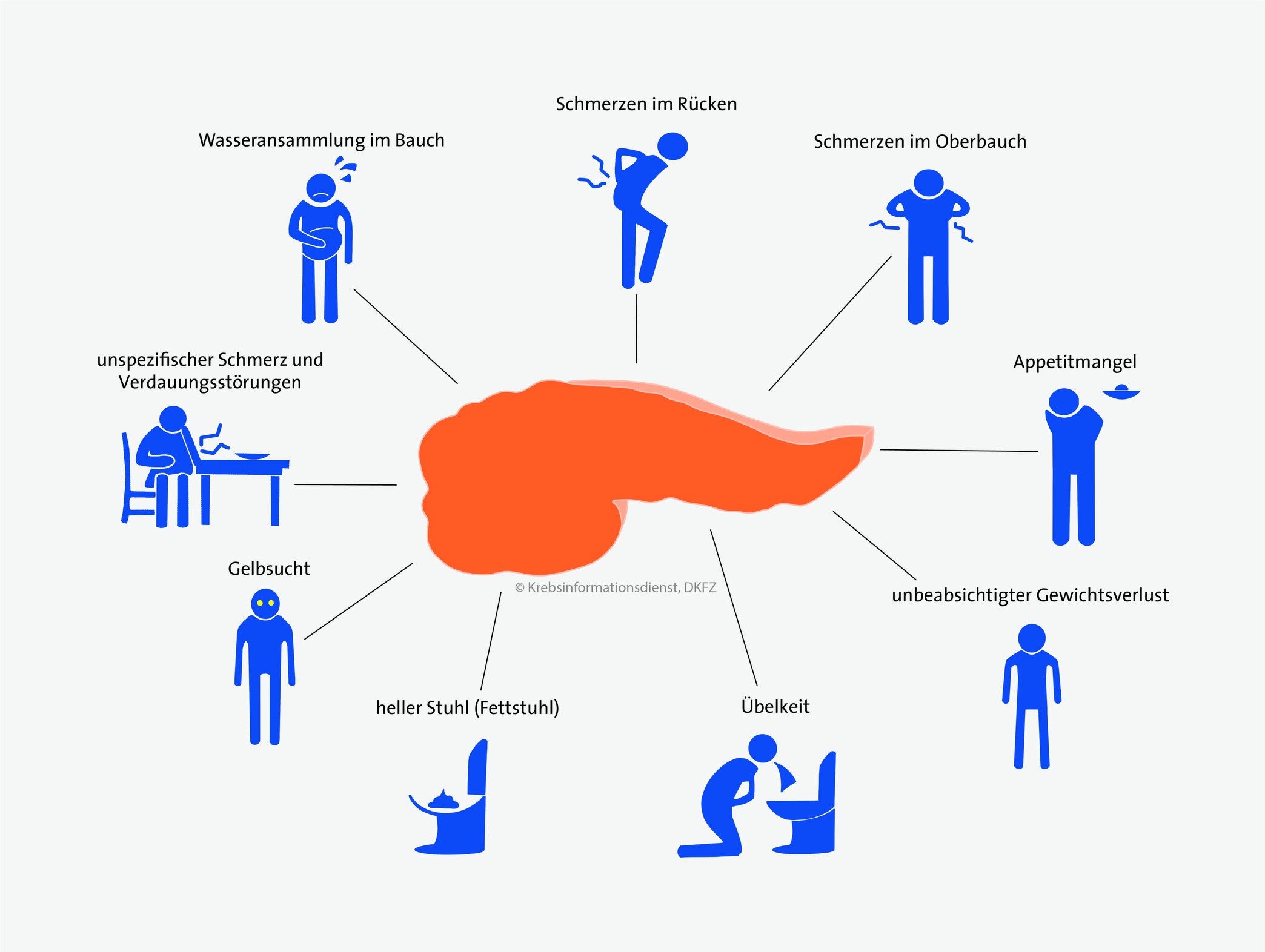 Schmerzen Anfangsstadium Bauchspeicheldrüse Entzündet Symptome www.krebsinformationsdienst.de