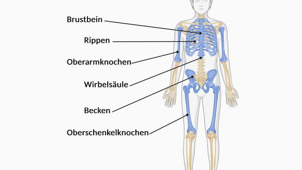 Darstellung des menschlichen Skeletts. Eingefärbt sind: Brustbein, Rippen, Wirbelsäule, Becken sowie Oberarm- und Oberschenkelknochen.