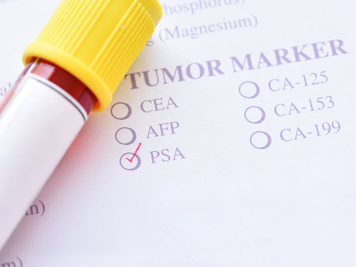 Tumormarker-Test, © jarun011, Thinkstock Blutröhrchen mit Testunterlagen