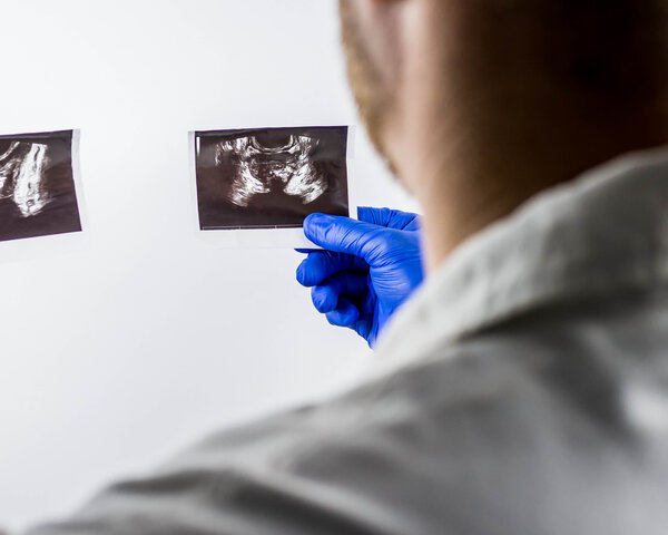Ein Arzt begutachtet Ultraschallbilder der Prostata.