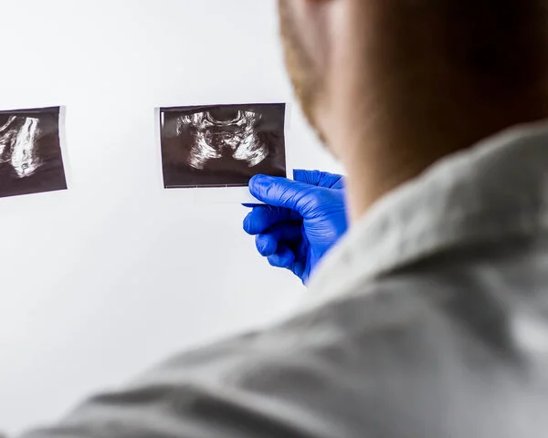 Ein Arzt begutachtet Ultraschallbilder der Prostata.
