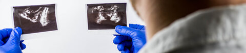 Ein Arzt begutachtet Ultraschallbilder der Prostata.