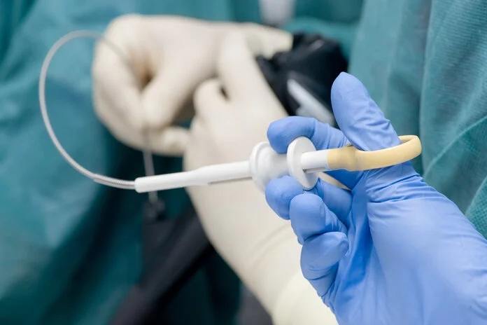 Endoskopische Biopsie, © zilli, iStock Eine Hand mit Schutzhandschuh hält eine Biopsienadel, deren Spitze in ein Endoskop eingeführt wird.