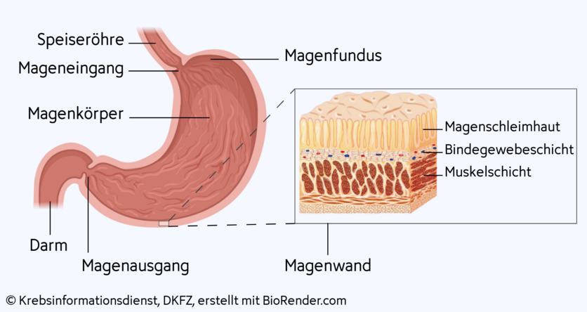 Aufbau des Magens mit Mageneingang, Magenfundus, Magenkörper und Magenausgang. Vergrößert dargestellt ist ein Stück Magenwand bestehend aus Magenschleimhaut, Bindegewebsschicht und Muskelschicht.