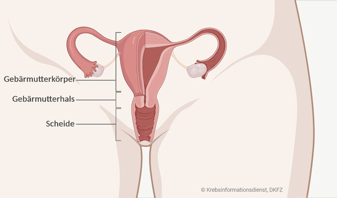 Anatomie der Gebärmutter, © Krebsinformationsdienst, DKFZ, erstellt mit BioRender.com Grafische Darstellung von Gebärmutterkörper, Gebärmutterhals und Scheide.
