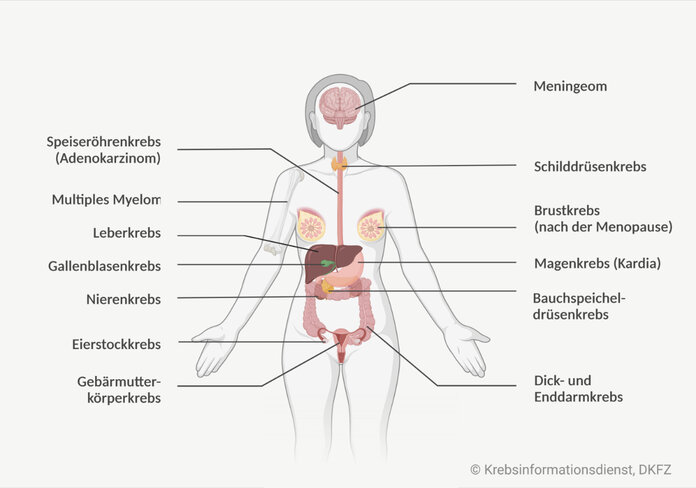 Krebserkrankungen im Zusammenhang mit starkem Übergewicht , Krebsinformationsdienst, DKFZ, erstellt mit BioRender.com Person mit markierten Organen, die ein erhöhtes Adipositas-bedingtes Krebsrisiko haben.