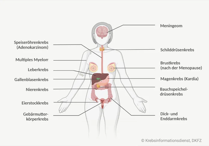 Person mit markierten Organen, die ein erhöhtes Adipositas-bedingtes Krebsrisiko haben.