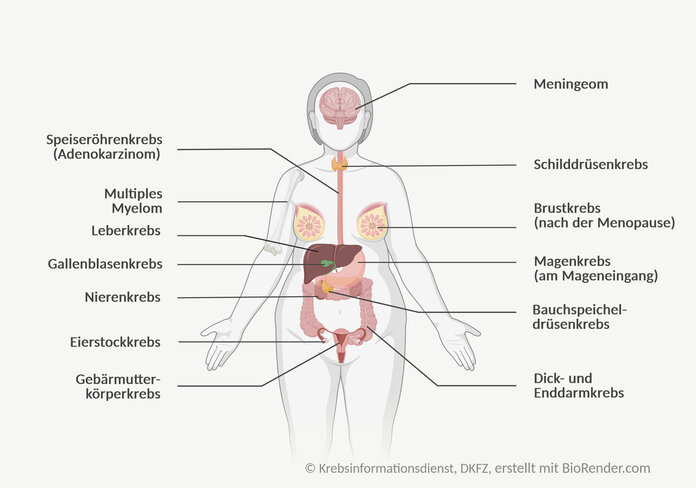 Menschliche Silhouette mit Beschriftungen: Speiseröhrenkrebs, Multiples Myelom, Leberkrebs, Gallenblasenkrebs, Nierenkrebs, Eierstockkrebs, Gebärmutterkörperkrebs, Meningeom, Schilddrüsenkrebs, Brustkrebs (nach der Menopause), Magenkrebs (am Mageneingang), Bauchspeicheldrüsenkrebs, Dick- und Enddarmkrebs.
