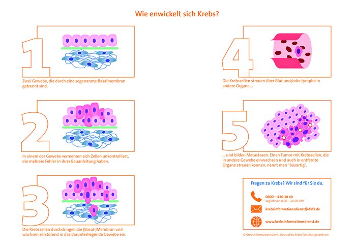 Graphik zur Krebsentstehung Graphik zur Krebsentstehung © Krebsinformationsdienst, Deutsches Krebsforschungszentrum