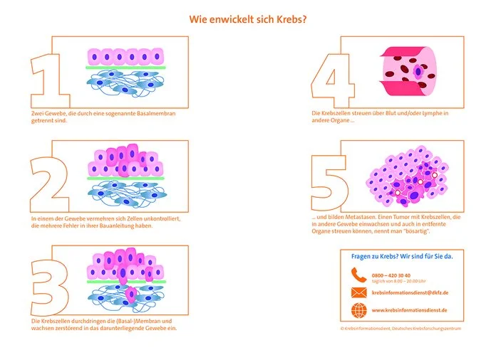 Graphik zur Krebsentstehung Graphik zur Krebsentstehung © Krebsinformationsdienst, Deutsches Krebsforschungszentrum