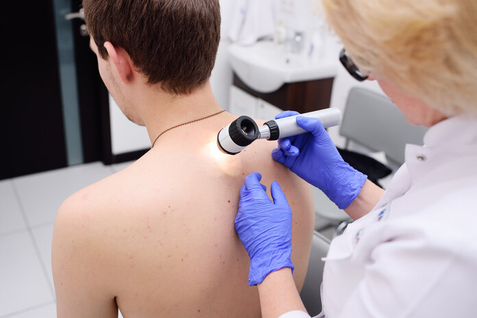 Dermatoskop, © kalinovskiy, freepik Ärztin untersucht mit einem Auflichtmikroskop die Haut auf dem Rücken eines Mannes.