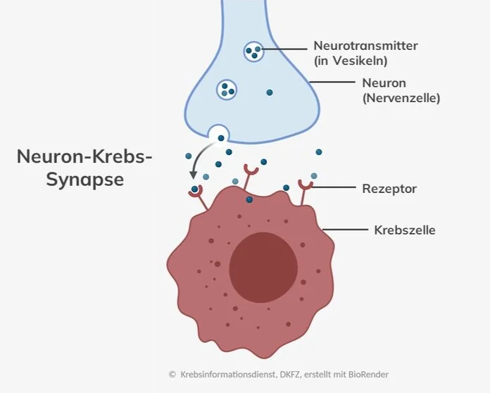 Verbindung (Synapse) zwischen Nervenzelle (Neuron) und Krebszelle: Die Nervenzelle schüttet Botenstoffe (Neurotransmitter) in den synaptischen Spalt aus. Die Krebszelle empfängt die Signale über Bindungsstellen auf ihrer Oberfläche (Rezeptoren).