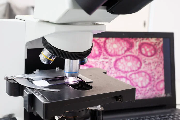 Mikroskop, © Komsan Loonprom, Shutterstock Objektträger liegt unter einem Mikroskop, im Hintergrund zeigt ein Bildschirm ein histologisches Bild.