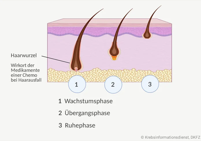 Haarwachstum, © Krebsinformationsdienst, DKFZ; erstellt mit BioRender.com Graphische Darstellung der drei Phase des Haarzyklus: 1. Wachstumsphase, 2. Übergangsphase und 3. Ruhephase. Die Haarwurzel ist beschriftet: Wirkort der Medikamente einer Chemo bei Haarausfall.