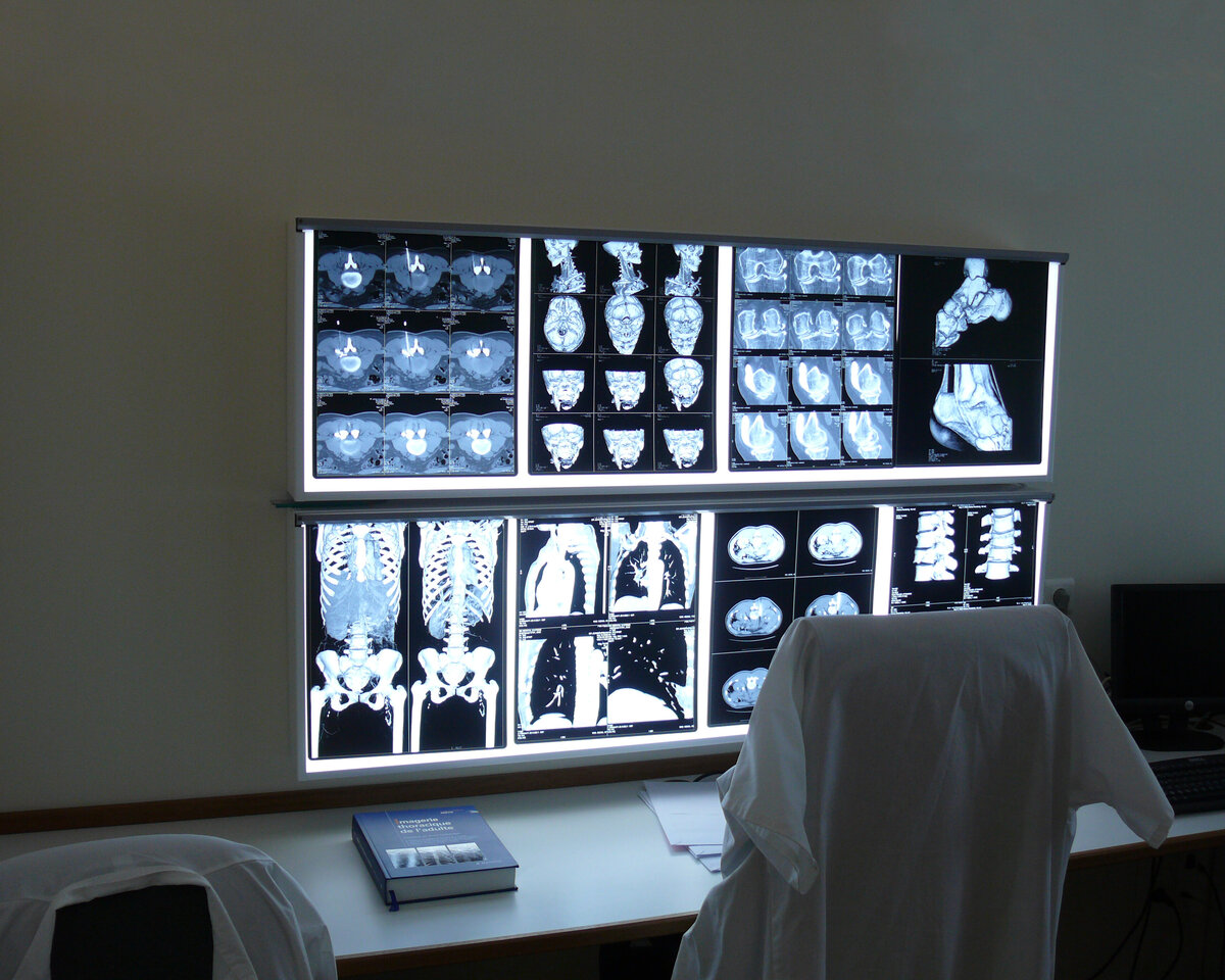 Ultraschall zu Diagnose von Krebs Häufig gestellte Fragen DKFZ Krebsinformationsdienst