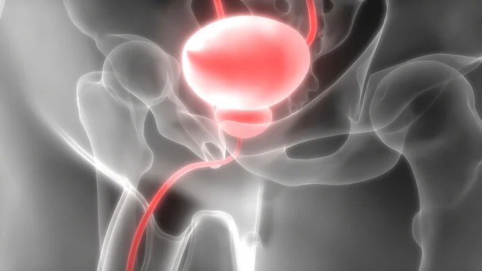 Harnblase, © magicmine - Fotolia Anatomische Darstellung der Harnblase