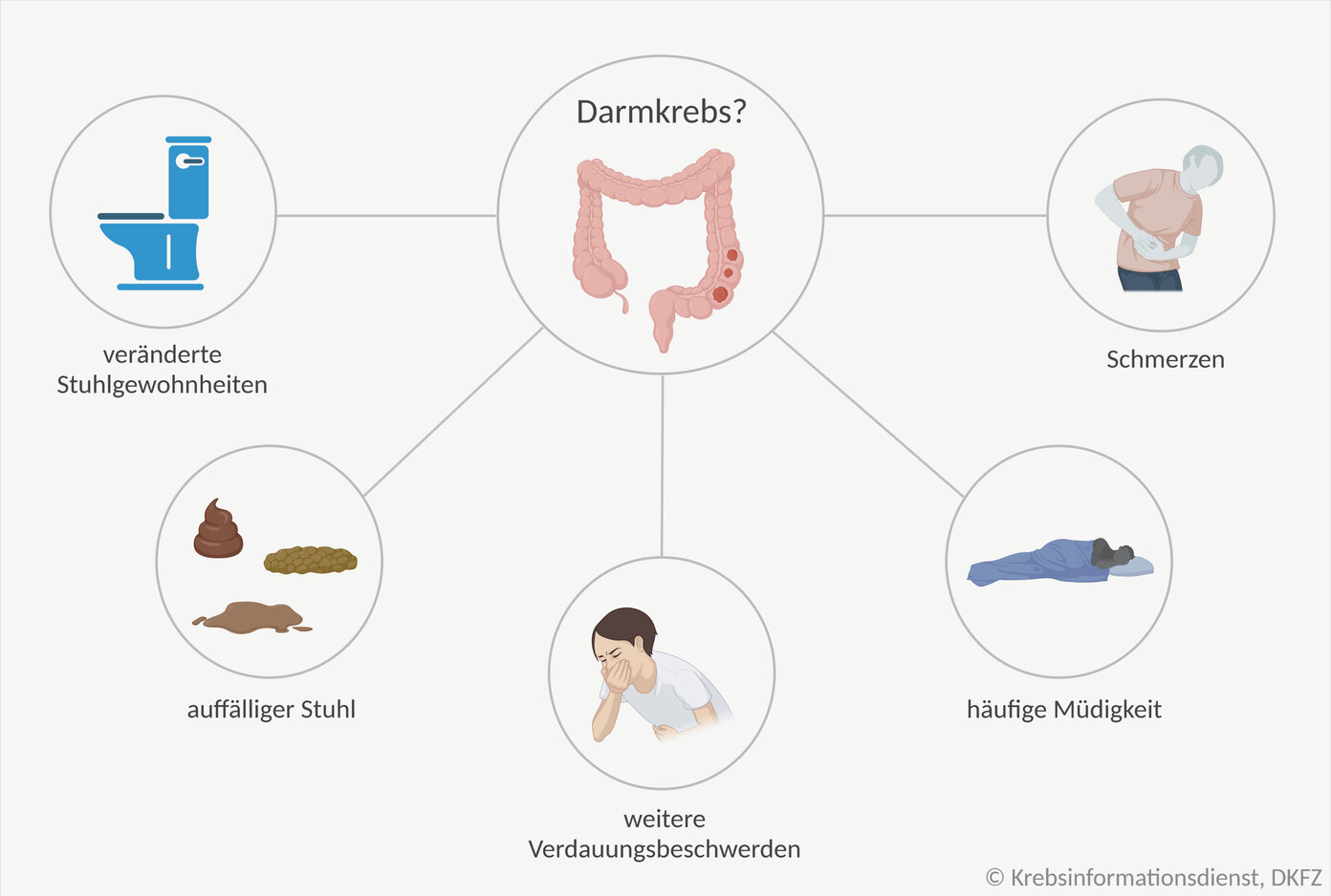 Wo Hat Man Bei Darmkrebs Schmerzen