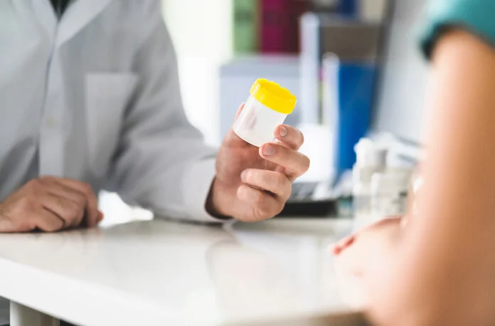 Urinuntersuchung, © Tero Vesalainen, Shutterstock Arzt gibt einem Patienten einen Urinbecher.