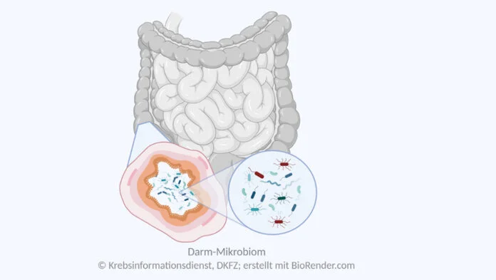 Mikrobiom des Darms, © Krebsinformationsdienst, DKFZ; erstellt mit BioRender.com Grafik des Dickdarms mit schematischer Vergrößerung eines Dickdarmquerschnitts und Mikroskop-Ansicht von Bakterien des Darm-Mikrobioms