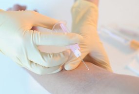 Eine Infusionsnadel wird gelegt, Foto: Tobias Schwerdt © Krebsinformationsdienst, Deutsches Krebsforschungszentrum