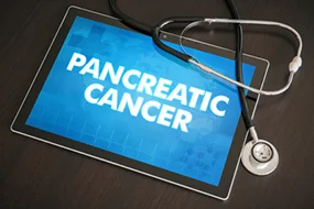 Pankreaskrebs © Fotolia/ibreakstock