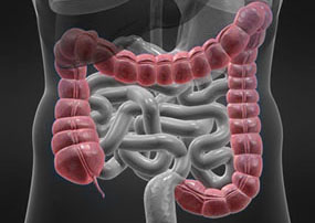 Darm , Sebastian Kaulitzki/Fotolia Darm © Sebastian Kaulitzki/Fotolia